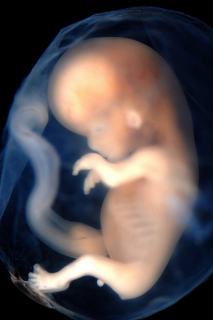 fetus.jpg